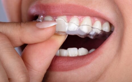 Kobieta z problmem bruksizmu zakąłda na zęby ochronke
